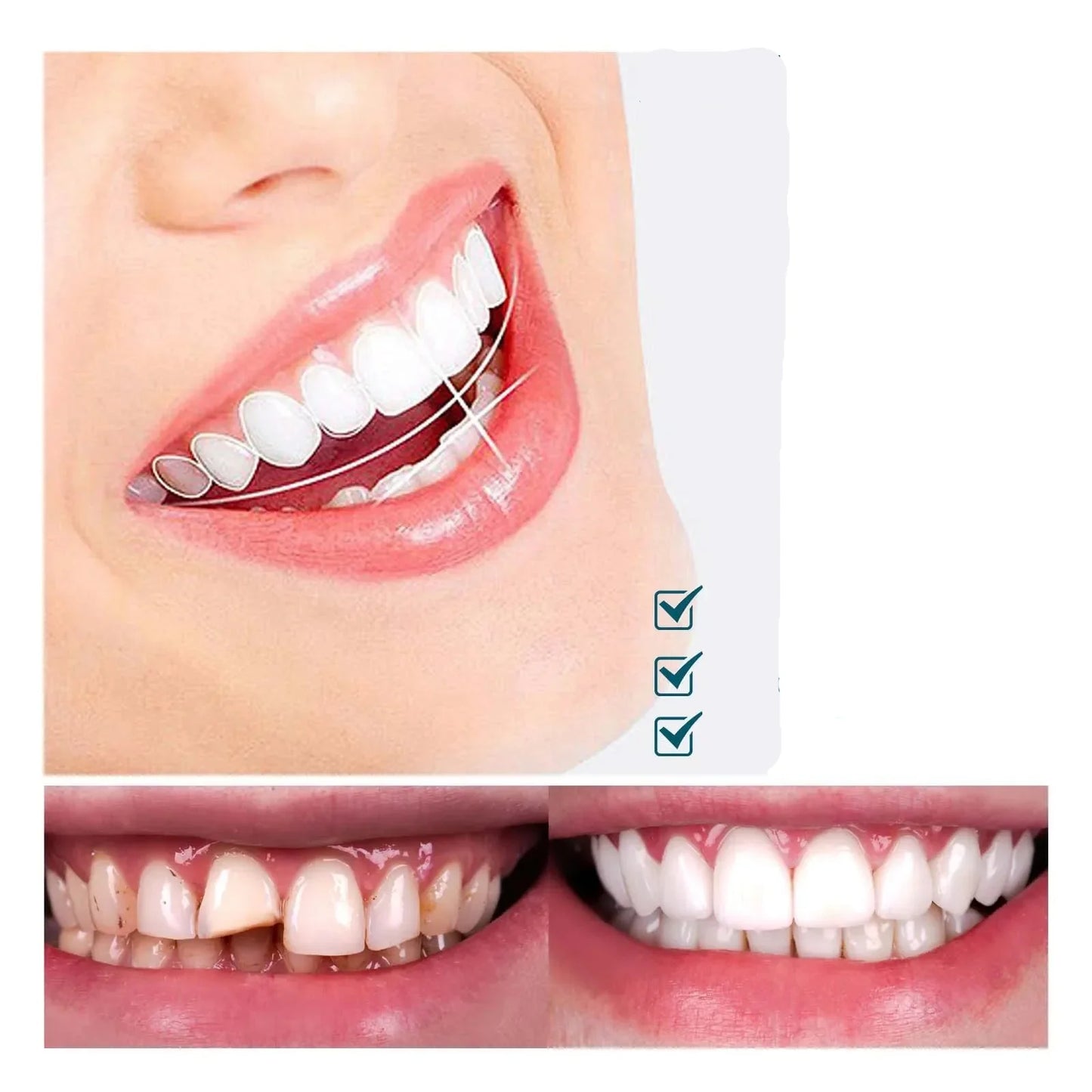 Facetas Dentárias Naturais,Elegante Branco Silicone Dentes Ferramenta Temporária Sorriso Perfeito Superior Inferior Falso